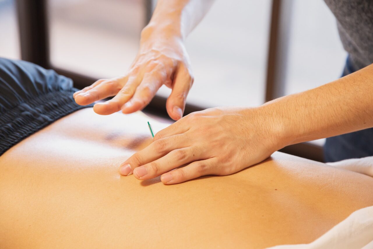Acupuncture at Body Mechanix